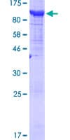 Human BRAT1 / BAAT1 Protein (Recombinant GST)