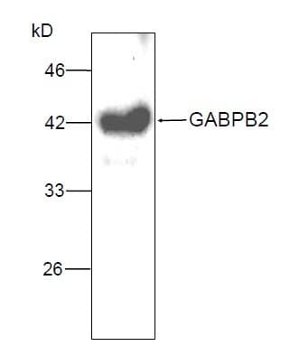 GABPB2 Antibody