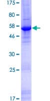 Human ZC3HAV1L Protein (Recombinant GST)