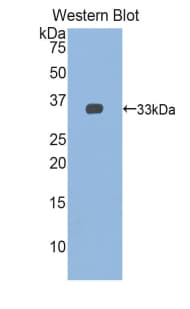 TNNT1 / TNT Antibody (aa1-261)