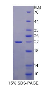 Mouse SHBG Protein (Recombinant His-T7)