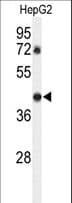Polyclonal Rabbit anti-Human DDX39 Antibody (aa250-277, WB)
