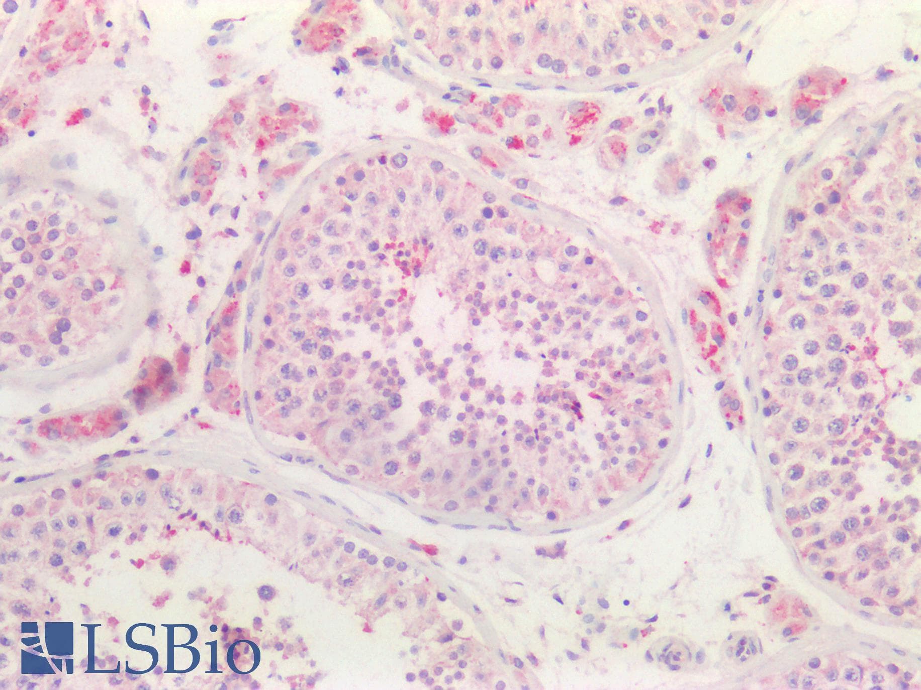 PathPlus™ GLS / Glutaminase Antibody