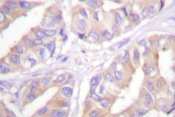 ARAF / ARAF1 / A-RAF Antibody (Asp297)