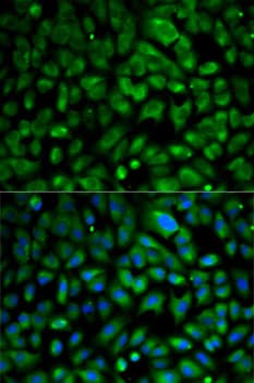 Polyclonal Rabbit anti-Human EIF4E Antibody (IF, WB)