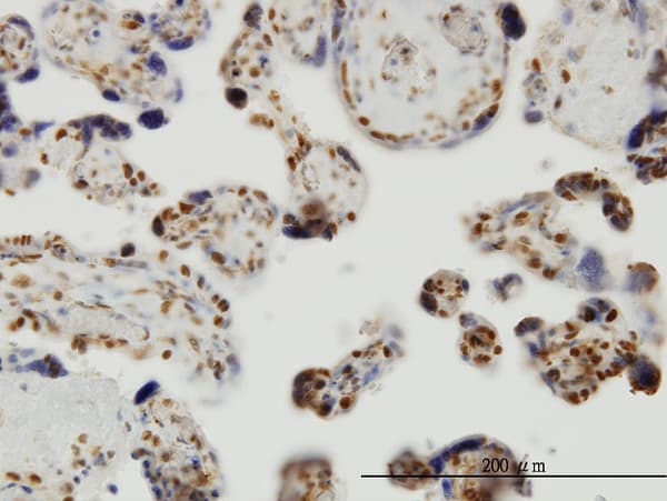 THUMPD1 Antibody (clone 4A11)