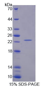 Mouse SHISA4 Protein (Recombinant His-T7)