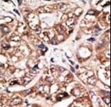 Polyclonal Rabbit anti-Human NEUROD1 Antibody (aa15-45, IHC, IF, WB)