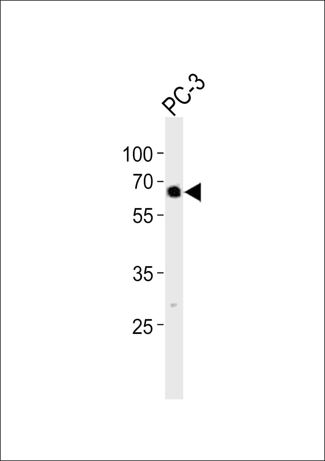 Polyclonal Rabbit anti-Human TBX22 Antibody (aa491-525, WB)