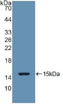 TGFB1 / TGF Beta 1 Antibody
