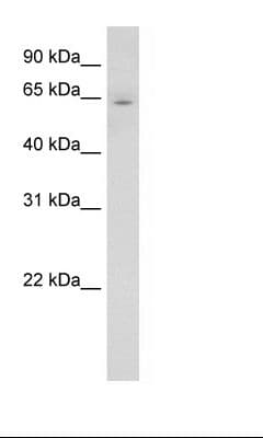 CYP2E1 Antibody (aa401-450, HRP)
