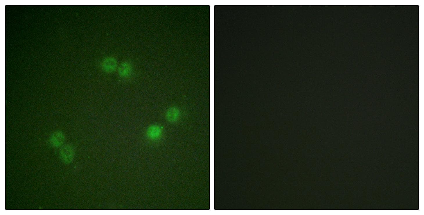 SF1 Antibody (phospho-Ser82)