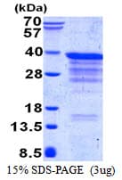 Human CLTB Protein (Recombinant His)