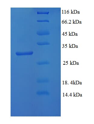 Human HNRNPA2B1 Protein (Recombinant 6His, N-terminus)