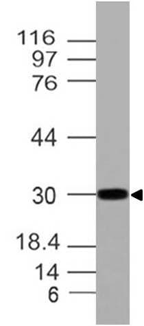 Polyclonal Rabbit anti-Human HOXA9 Antibody (WB)