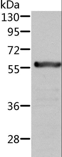 ALDH6A1 Antibody