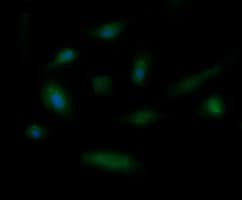 Monoclonal Mouse anti-Human CD105 Antibody (clone OTI9E5, IF, WB)