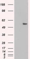 Monoclonal Mouse anti-Human KRT8 / CK8 / Cytokeratin 8 Antibody (clone OTI1B9, IF, WB)