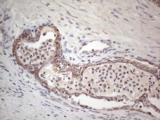 Monoclonal Mouse anti-Human RORB / ROR Beta Antibody (clone OTI1G1, Carrier-free, aa1-260, IHC, WB)