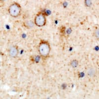 Polyclonal Rabbit anti-Human KIR3DL1 Antibody (N-Terminus, IHC, WB)