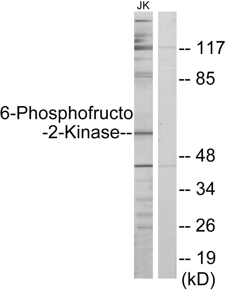PFKFB2 Antibody (aa1-50)