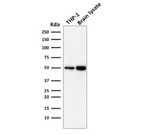APG5 / ATG5 Antibody (clone ATG5/2101)