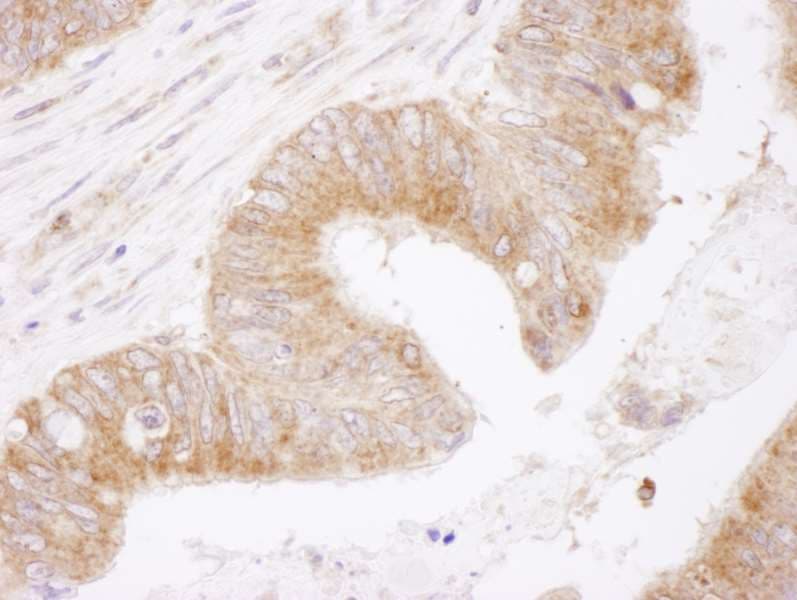 BCL2 / Bcl-2 Antibody (aa50-100)