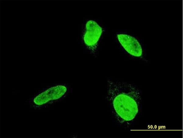 TESK2 Antibody (clone 5H4)
