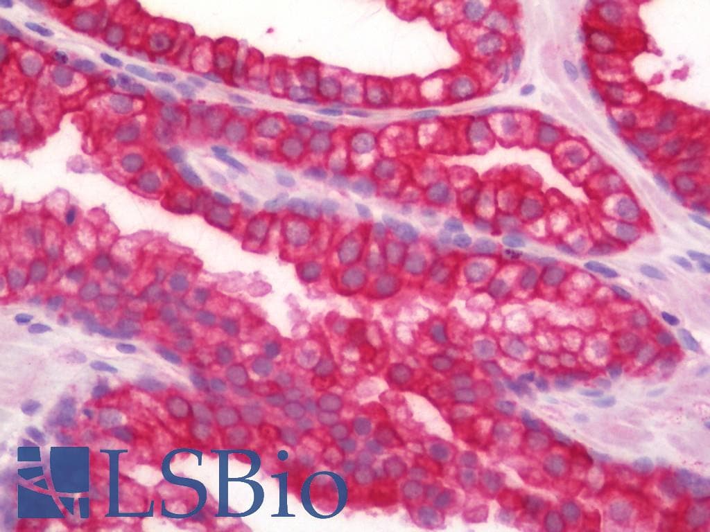 PathPlus™ ACHE / Acetylcholinesterase Antibody (aa536-585)