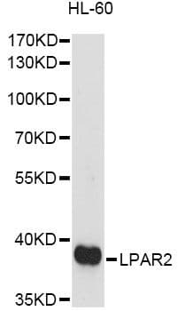 LPAR2 / EDG4 Antibody