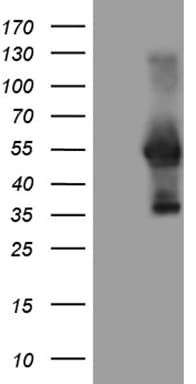 Monoclonal Mouse anti-Human WTAP Antibody (clone OTI6C3, Carrier-free, aa2-106, IHC, WB)