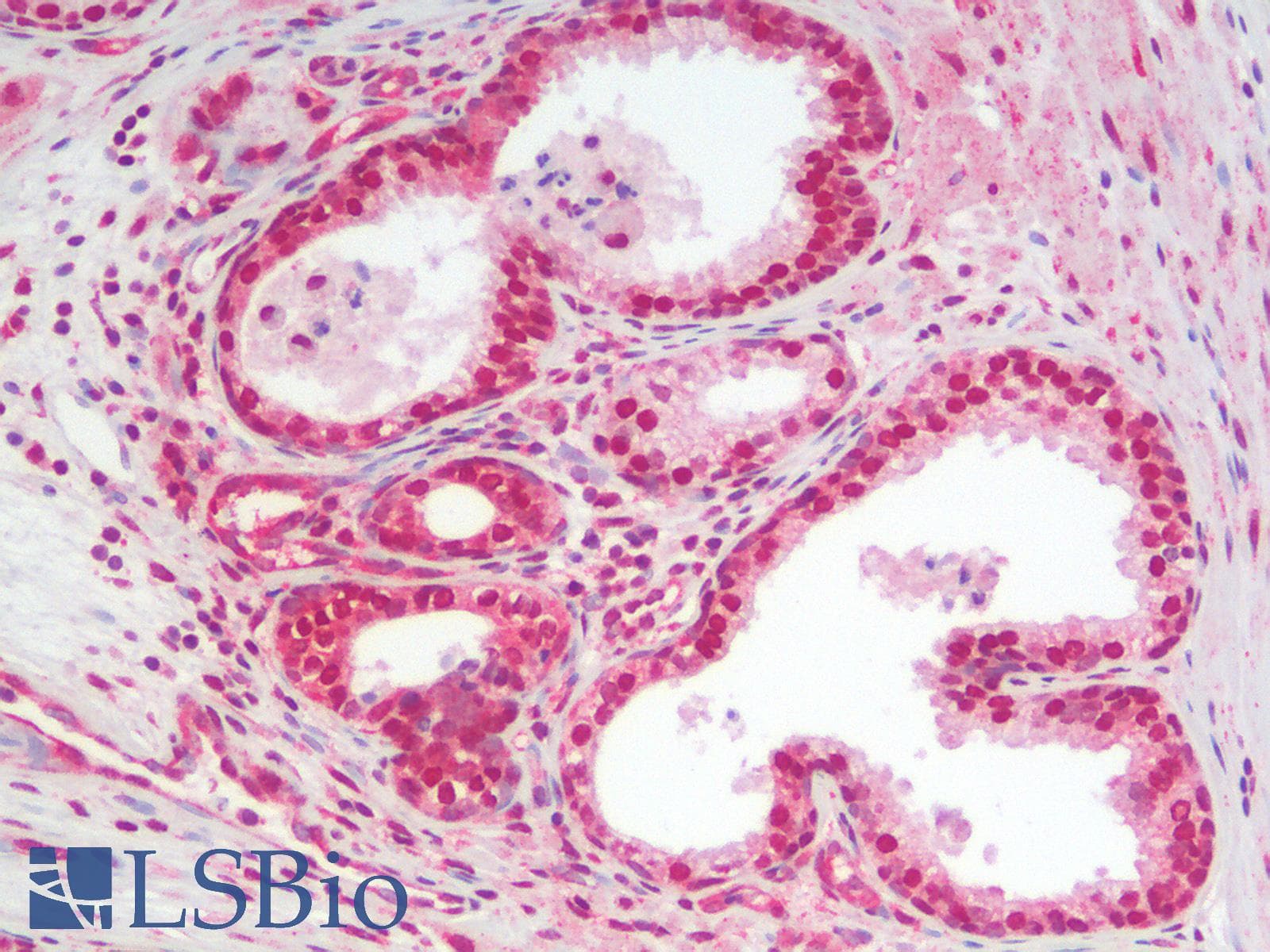 IHC-plus™ NFKBIA / IKB Alpha / IKBA Antibody