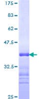 Human ARID1A / BAF250 Protein (Recombinant GST, N-terminus)