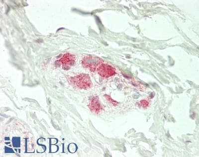 IHC-plus™ SMPD1 / Acid Sphingomyelinase Antibody (Internal)