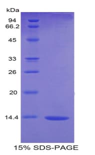 Rat VEGFD Protein (Recombinant His, N-Terminal)