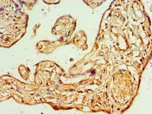 Polyclonal Rabbit anti-Human AIPL1 Antibody (aa1-384, IHC, WB)