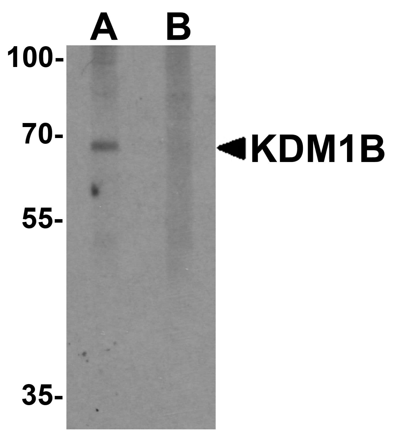 IHC-plus™ Polyclonal Rabbit anti-Human KDM1B Antibody (IHC, WB)