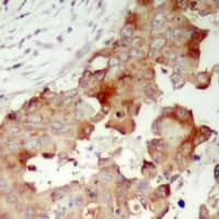 POTEB3 / POTE-15 Antibody (C-Terminus)