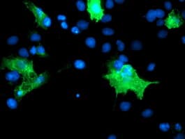 PECAM-1 / CD31 Antibody (clone OTI3B5)