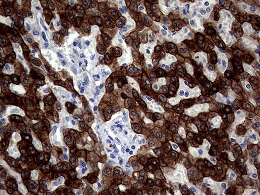 KRT18 / CK18 / Cytokeratin 18 Antibody (aa69-372, clone OTI10G8)