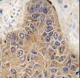 Polyclonal Rabbit anti-Human STUB1 / CHIP Antibody (aa203-231, IHC, WB)