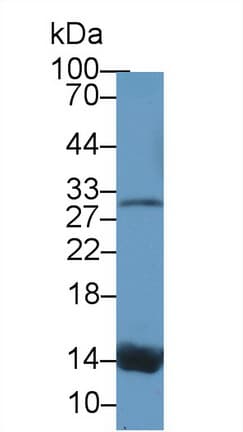 TTR / Transthyretin Antibody (aa23-147)