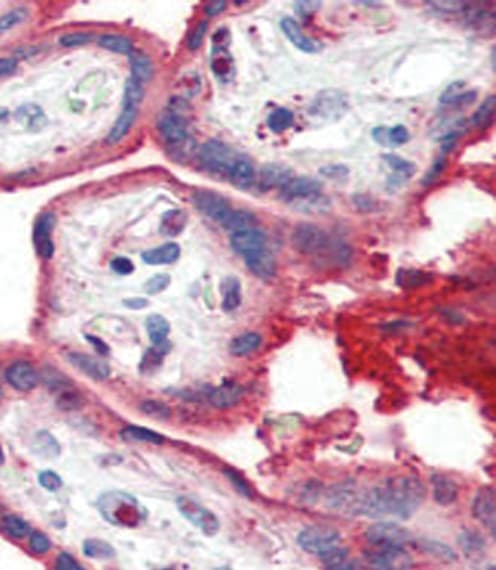 Polyclonal Rabbit anti-Human APOA1 / Apolipoprotein A 1 Antibody (aa10-37, IHC, WB)