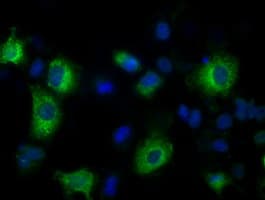 LOX / Lysyl Oxidase Antibody (clone OTI9B5)