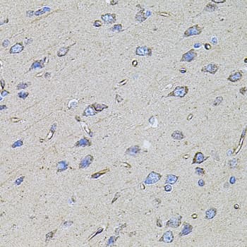 FLNB / TAP Antibody