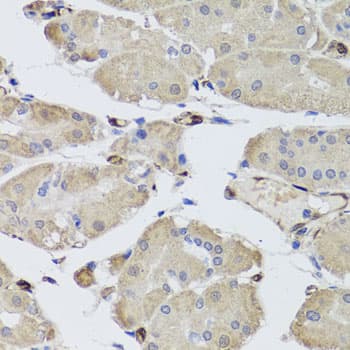 E-FABP / FABP5 Antibody