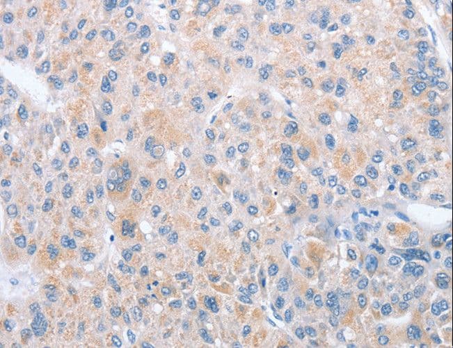 PARD6A / PAR6 Antibody