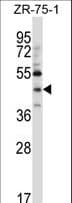 MATH2 / NEUROD6 Antibody (aa31-59)