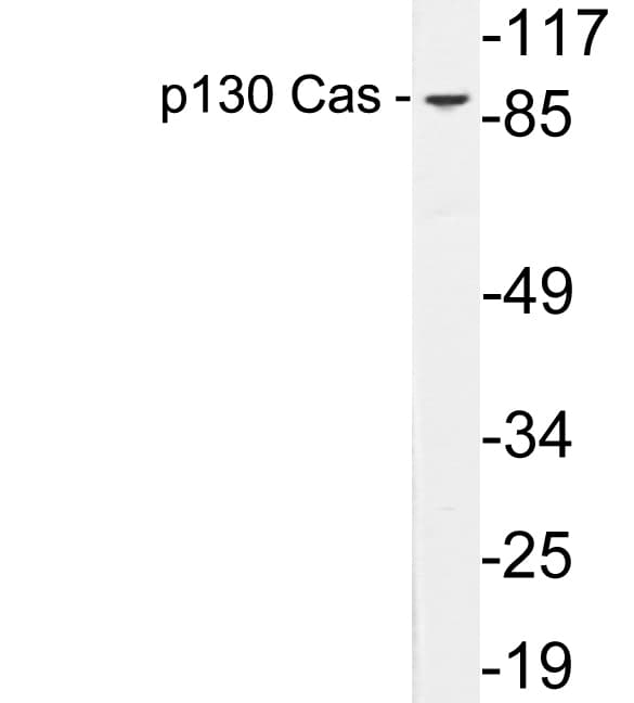 Polyclonal Rabbit anti-Human BCAR1 / p130Cas Antibody (aa361-410, WB)