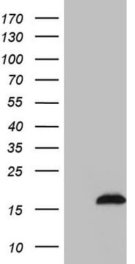 Monoclonal Mouse anti-Human SAMD12 Antibody (clone OTI2G1, IHC, WB)